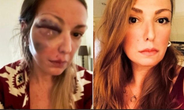 Στεφανία Τζαφέρη – Οργή για μηνύματα που δέχεται μετά τον ξυλοδαρμό της