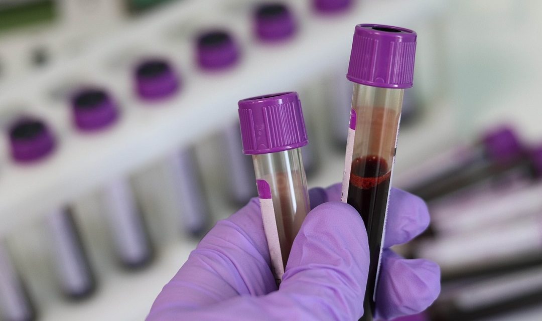 Μπορούν να ανιχνευθούν πλαστικά στο αίμα ανθρώπου;